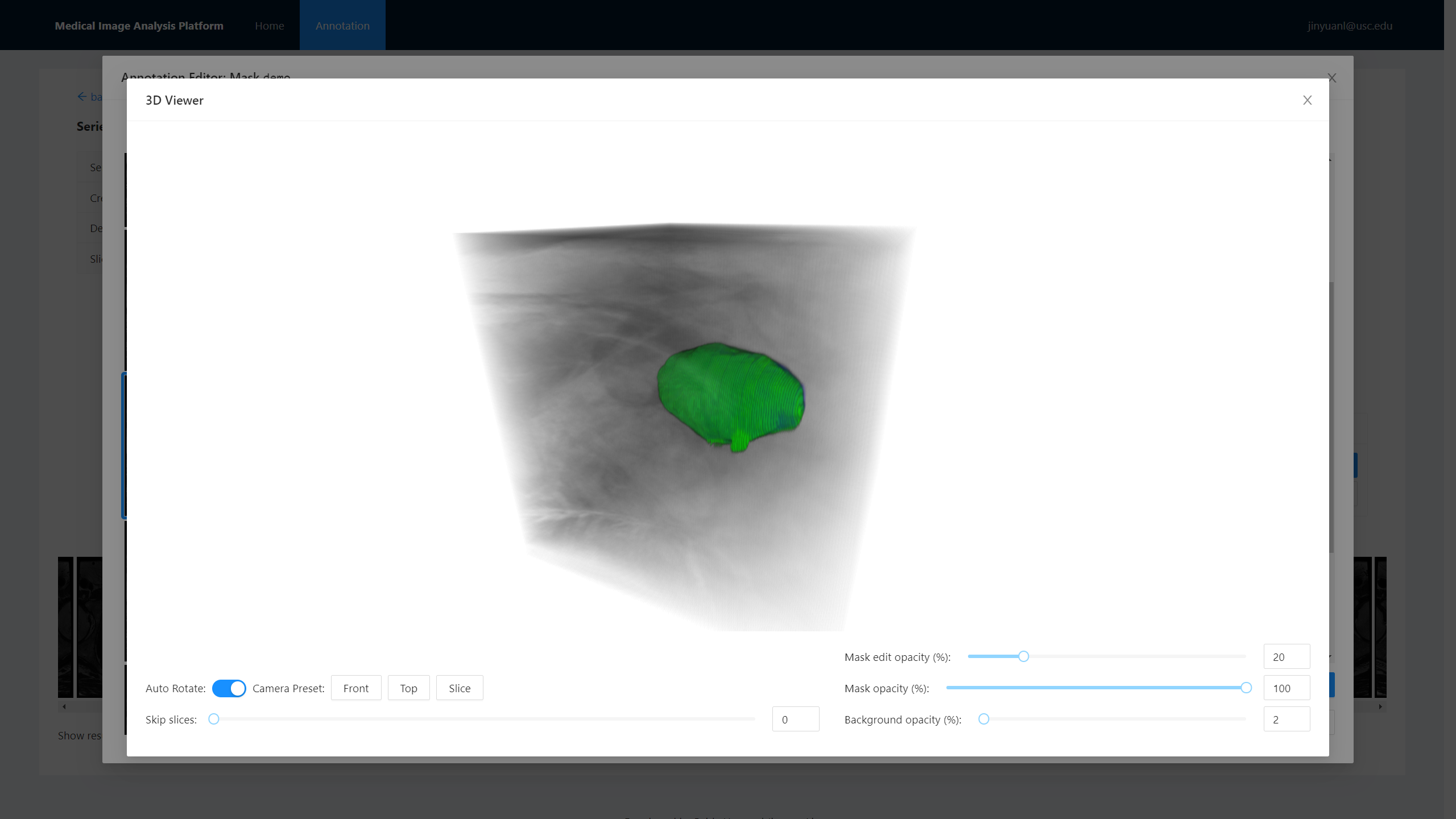 medical-image-analysis-platform_3d-viewer