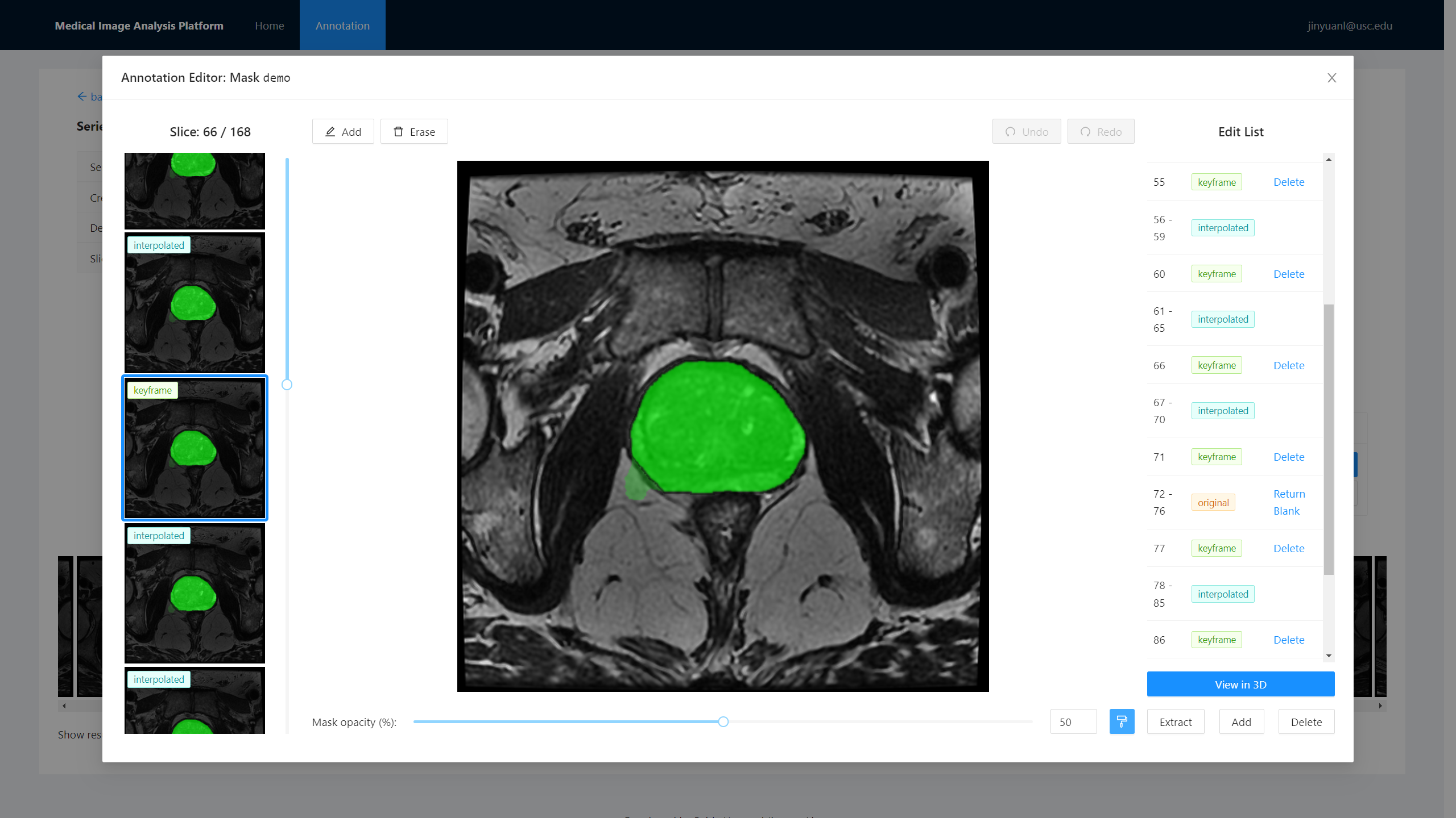 medical-image-analysis-platform_mask-editor