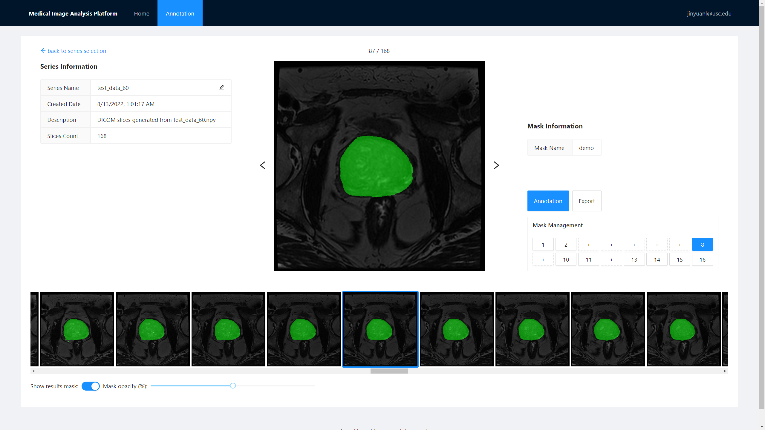 medical-image-analysis-platform_series-detail